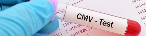 CMV test provrör