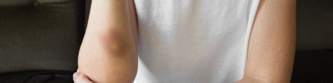 Blåmärke på kvinnas arm