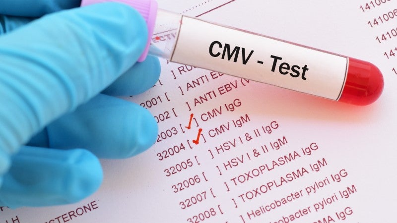 CMV test
